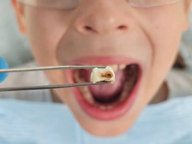 Best Urgent Dental Care for Toothache in Three Oaks, MI